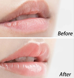 A_04 - Lip Care Repair