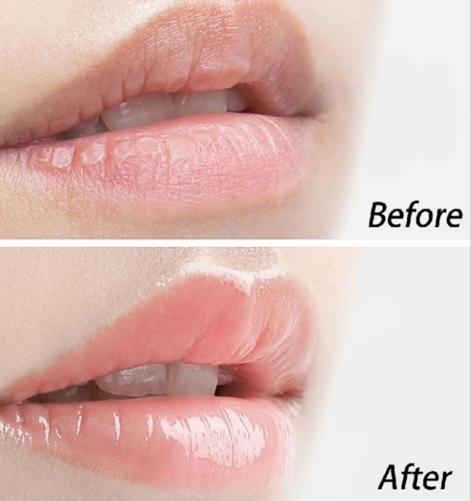 A_04 - Lip Care Repair